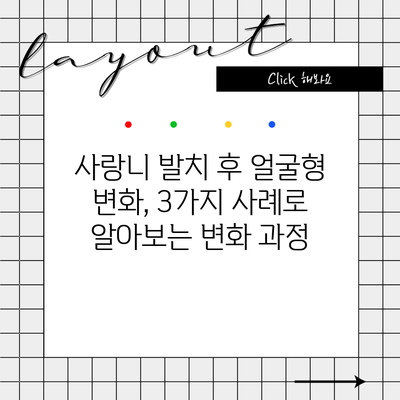 사랑니 발치 후 얼굴형 변화, 3가지 사례로 알아보는 변화 과정