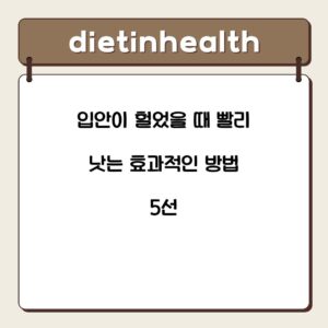 입안이 헐었을 때 빨리 낫는 효과적인 방법 5선