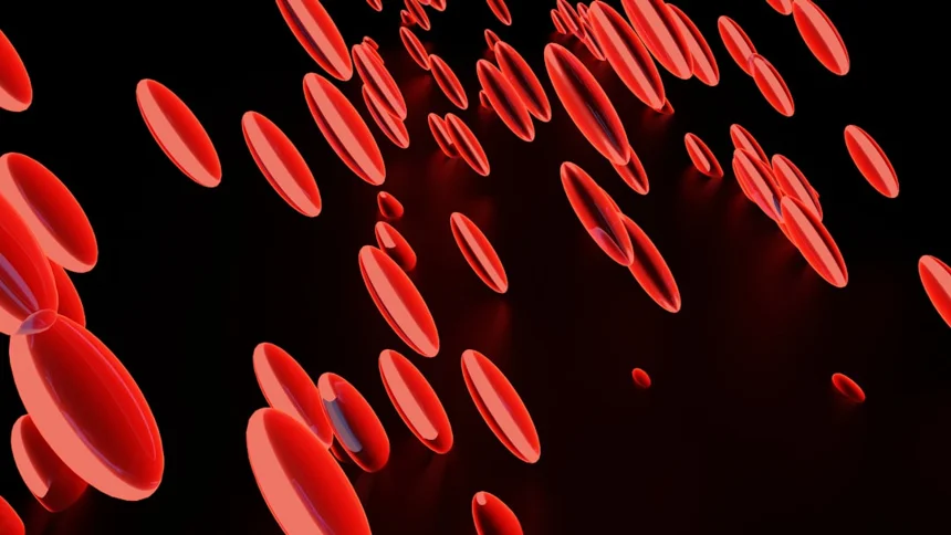 Anemia