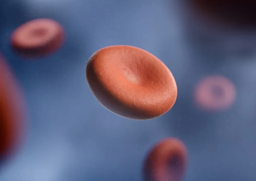 Anemia