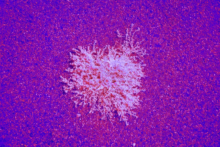 Anemia