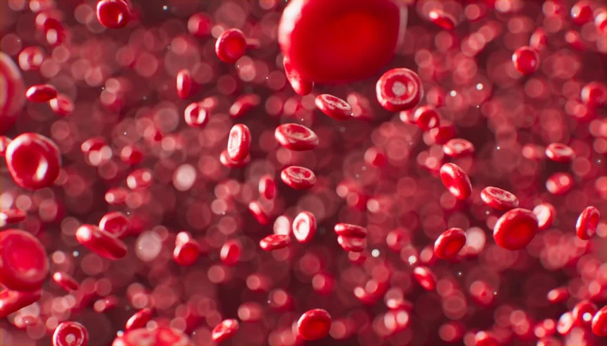 Anemia