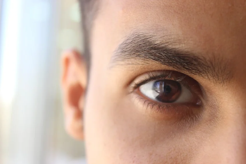 Astigmatism