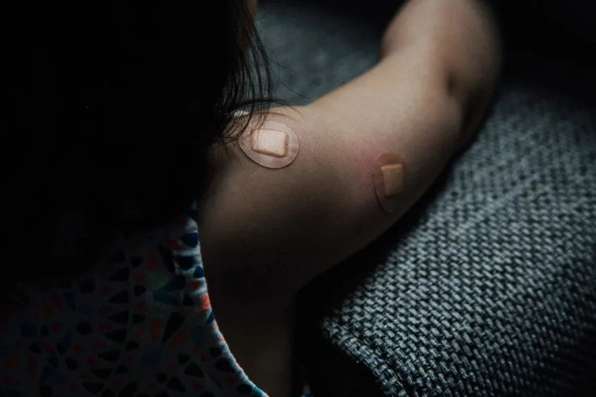Bruise.