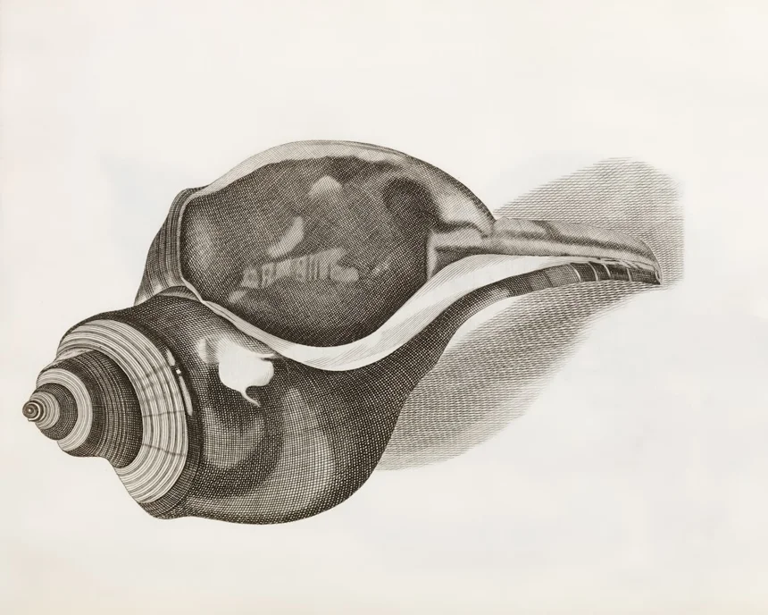 Cholelithiasis