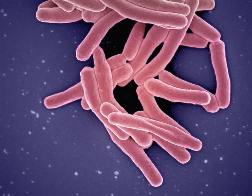 Cholera