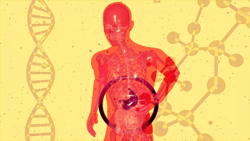 Colon cancer