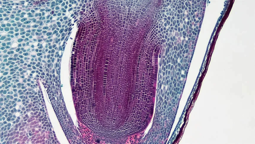 Folliculitis