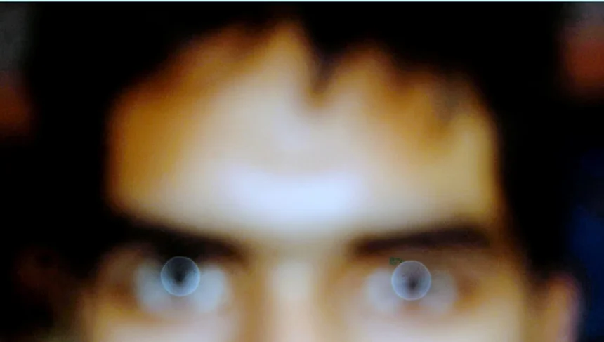 Forehead