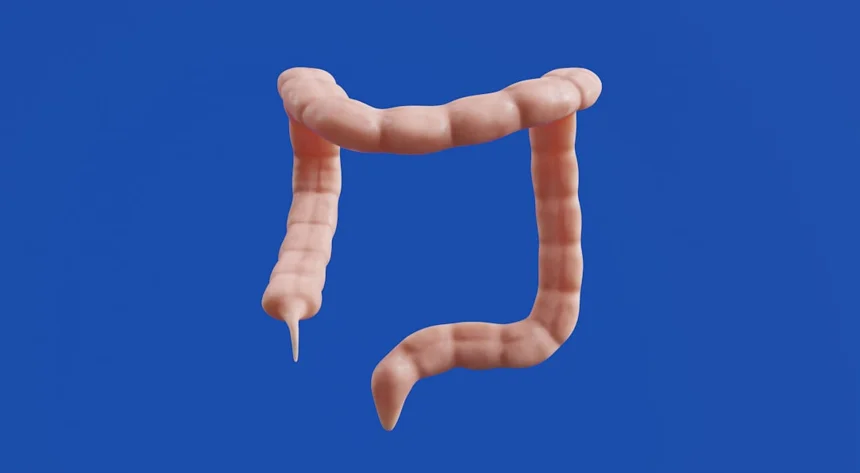 Gastritis
