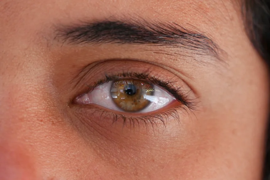 Glaucoma