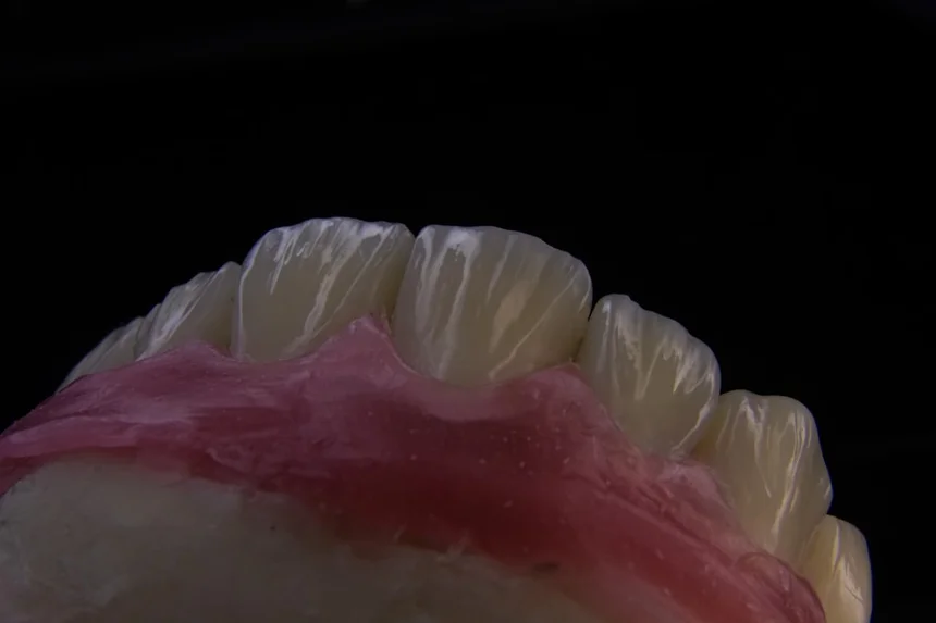 Guar Gum