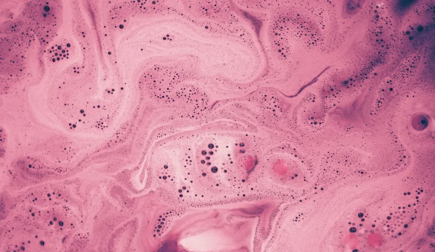 Gynecomastia