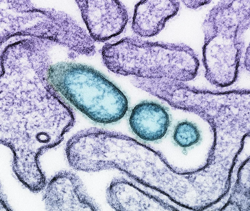 Herpes
