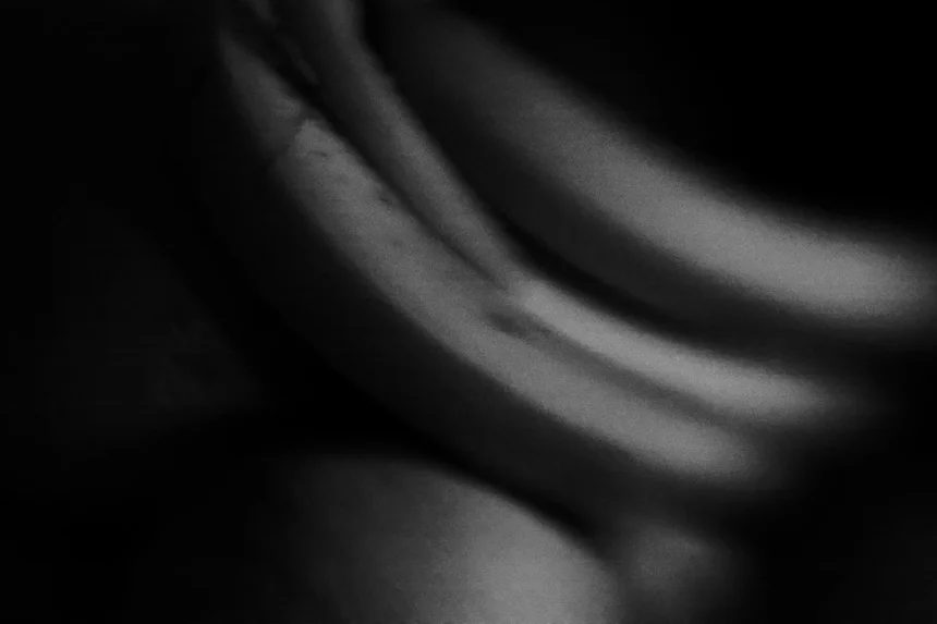 Hypotension