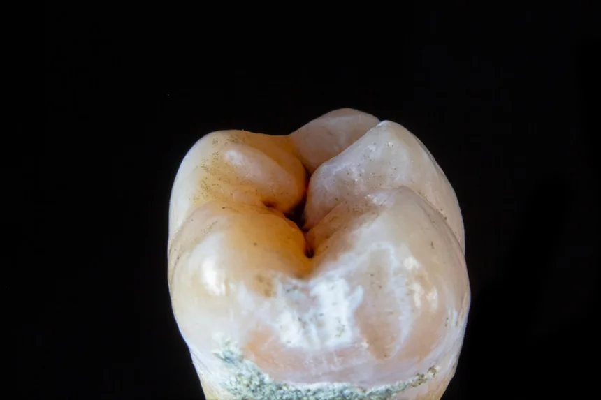 Implant