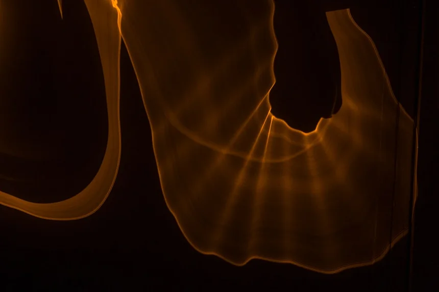 Irritable Bowel Syndrome