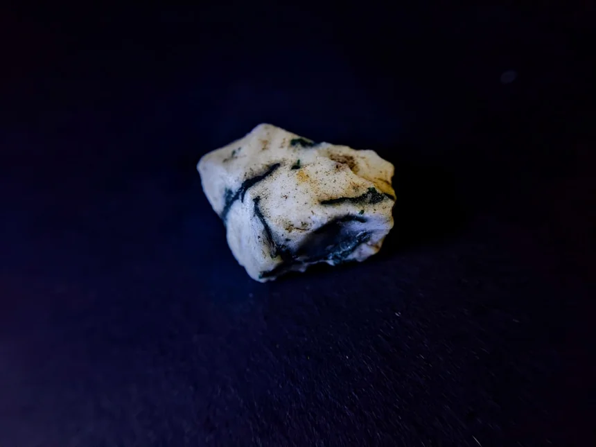 Kidney stone