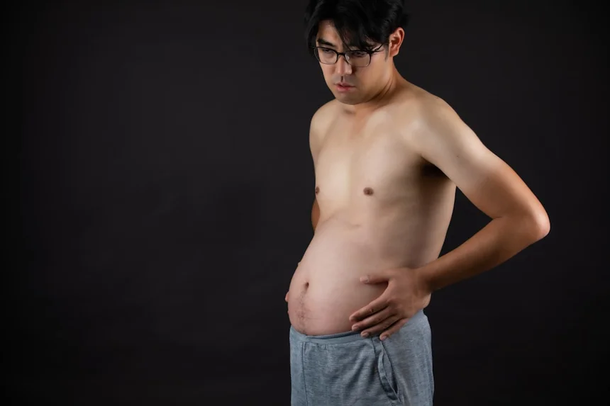 Liposuction