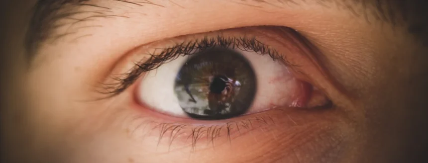 Myopia