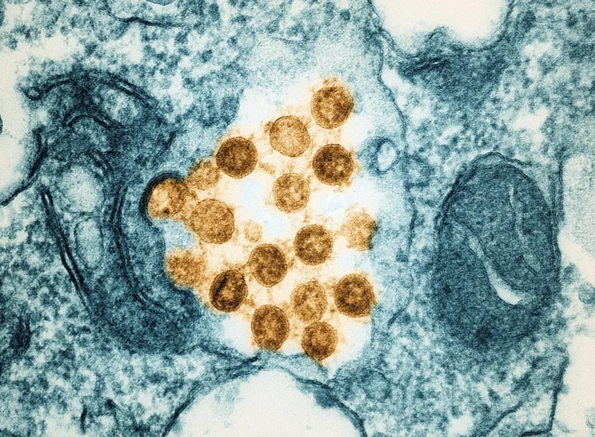 Norovirus