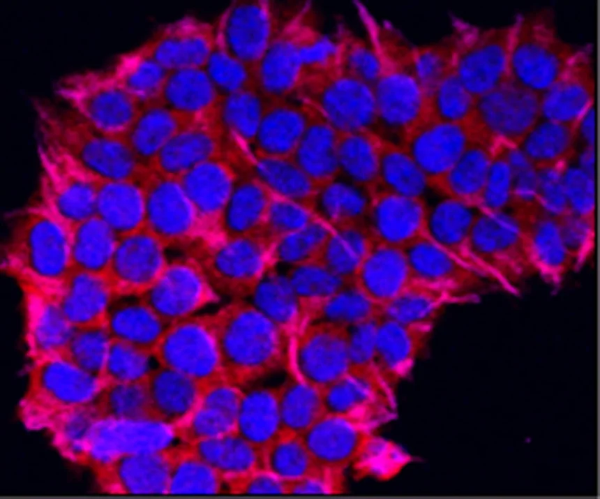 Oncology