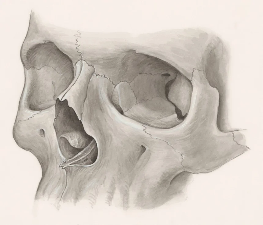 Osteoporosis