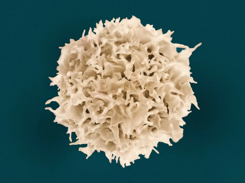 Rheumatoid.