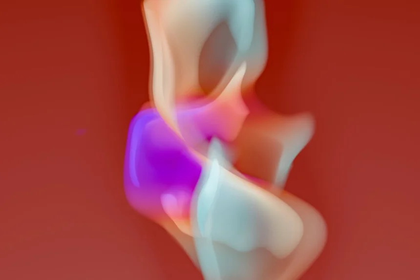 Sinusitis