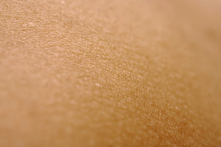Skin cancer