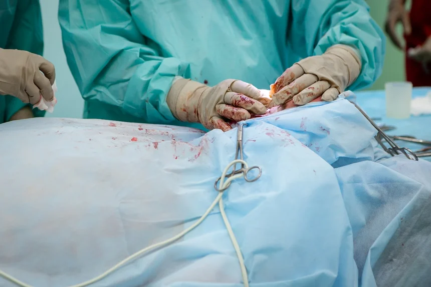 Surgery