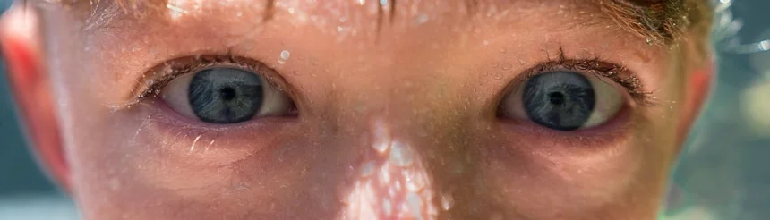 Swelling
