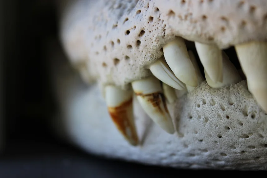 Tooth decay