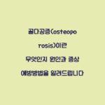 골다공증(osteoporosis)이란 무엇인지 원인과 증상 예방방법을 알려드립니다