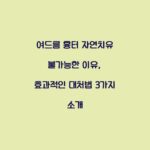 여드름 흉터 자연치유 불가능한 이유, 효과적인 대처법 3가지 소개