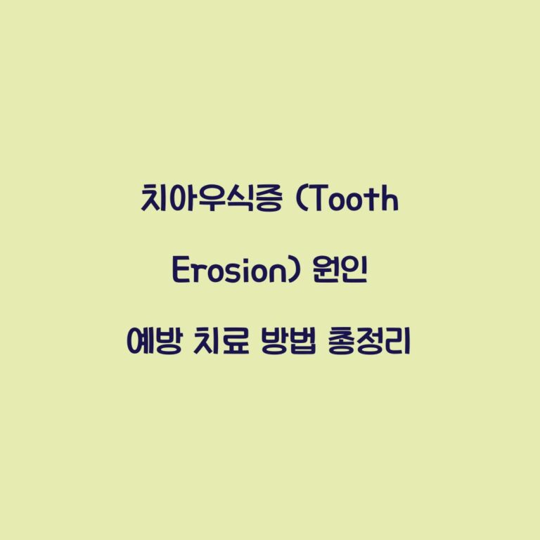 치아우식증 (Tooth Erosion) 원인 예방 치료 방법 총정리