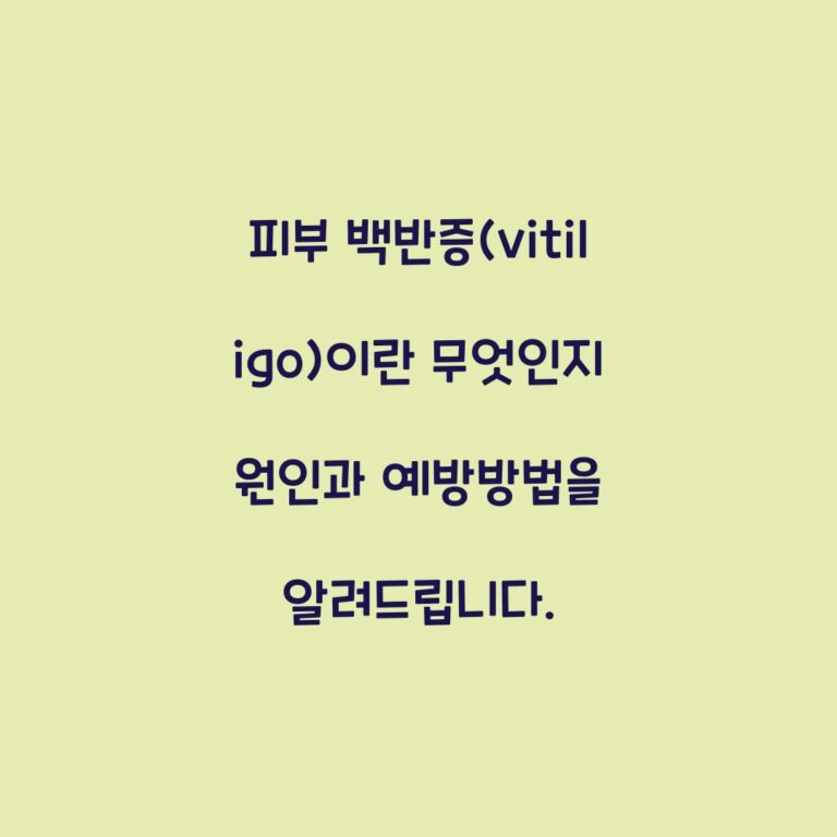 피부 백반증(vitiligo)이란 무엇인지 원인과 예방방법을 알려드립니다.